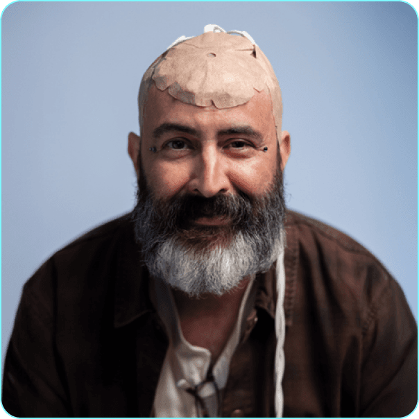 Fink with the transducer arrays on his head.